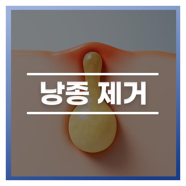 낭종제거는 경험이 많은 성형외과 전문의에게 치료받는 것이 좋습니다